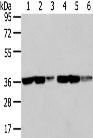 Anti-Transaldolase Rabbit Polyclonal Antibody