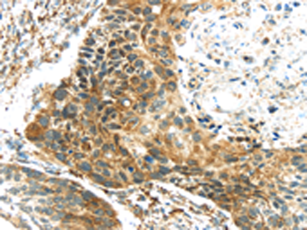 Anti-TGM4 Rabbit Polyclonal Antibody