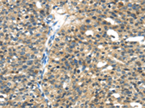 Anti-TGM5 Rabbit Polyclonal Antibody