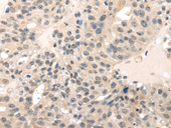Anti-MED28 Rabbit Polyclonal Antibody