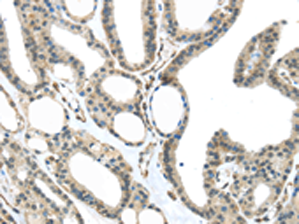 Anti-MED18 Rabbit Polyclonal Antibody