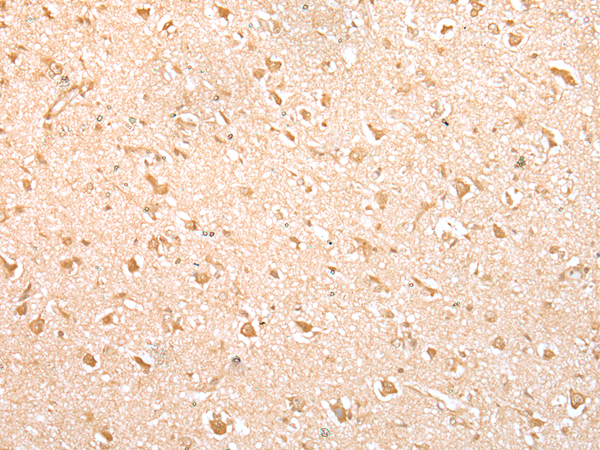 Anti-MED6 Rabbit Polyclonal Antibody