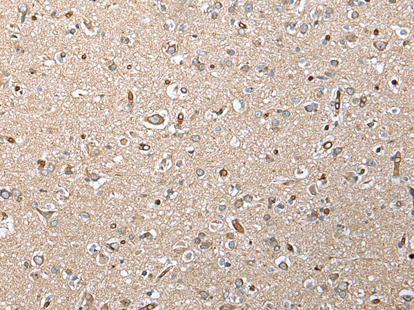 Anti-TREM1 Rabbit Polyclonal Antibody