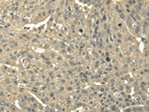 Anti-TRIB2 Rabbit Polyclonal Antibody