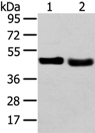 Anti-TRIB2 Rabbit Polyclonal Antibody