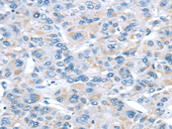 Anti-ITPA Rabbit Polyclonal Antibody