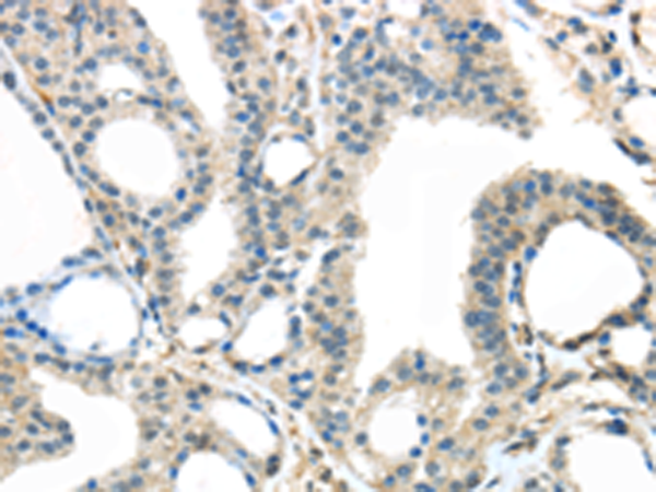 Anti-TRPM2 Rabbit Polyclonal Antibody