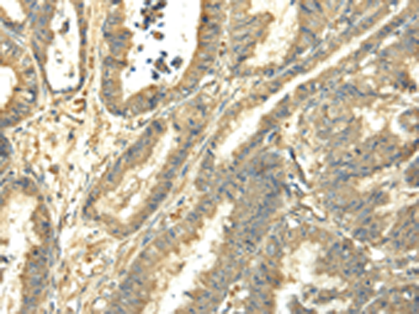 Anti-alpha IC Tubulin Rabbit Polyclonal Antibody