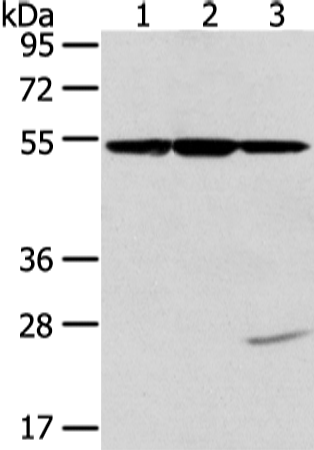 Anti-alpha IC Tubulin Rabbit Polyclonal Antibody