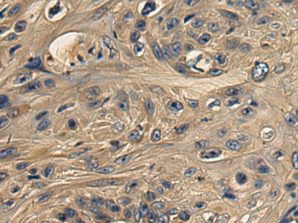 Anti-DNAJB11 Rabbit Polyclonal Antibody