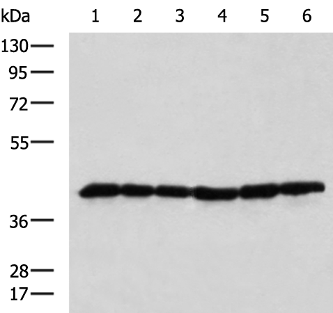 Anti-DNAJB11 Rabbit Polyclonal Antibody