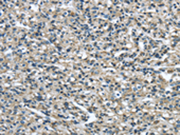 Anti-ER Protein 44 Rabbit Polyclonal Antibody