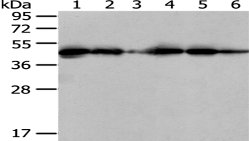 Anti-ER Protein 44 Rabbit Polyclonal Antibody