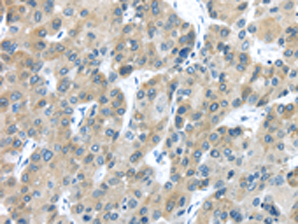 Anti-TXNDC5 Rabbit Polyclonal Antibody
