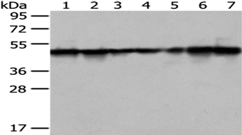 Anti-TXNDC5 Rabbit Polyclonal Antibody
