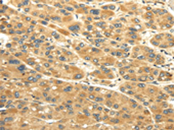 Anti-UACA Rabbit Polyclonal Antibody