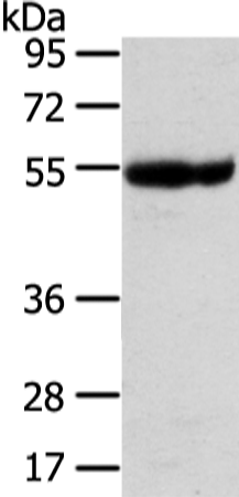 Anti-Ubiquitin Associated Protein 1 Rabbit Polyclonal Antibody