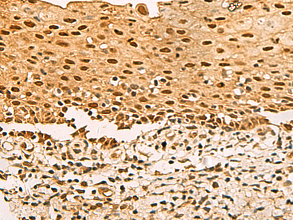 Anti-UBLCP1 Rabbit Polyclonal Antibody