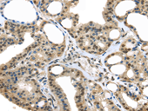 Anti-UCHL3 Rabbit Polyclonal Antibody
