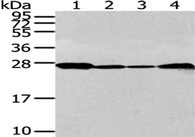 Anti-UCHL3 Rabbit Polyclonal Antibody