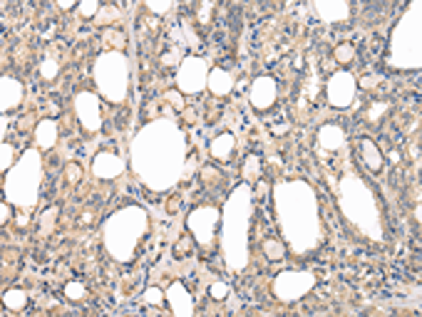 Anti-PPP5C Rabbit Polyclonal Antibody
