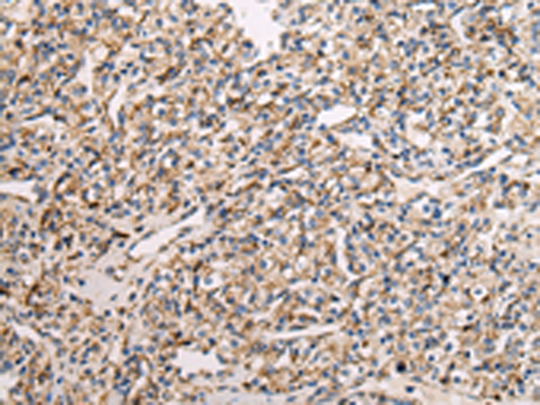 Anti-Complex III Subunit 1 Rabbit Polyclonal Antibody