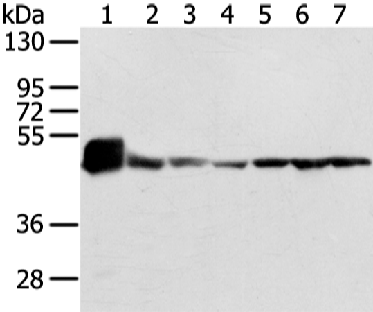 Anti-Complex III Subunit 1 Rabbit Polyclonal Antibody