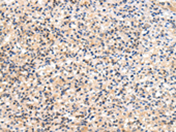 Anti-USP47 Rabbit Polyclonal Antibody