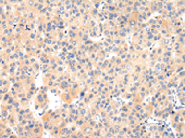 Anti-VASH1 Rabbit Polyclonal Antibody