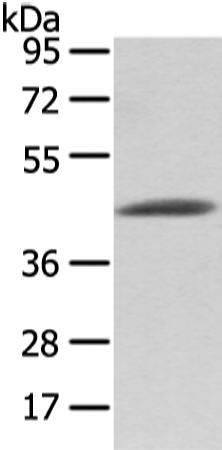 Anti-VASH1 Rabbit Polyclonal Antibody
