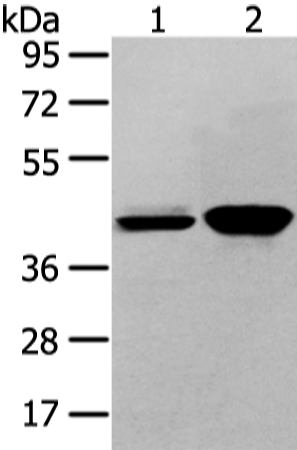 Anti-VASH2 Rabbit Polyclonal Antibody