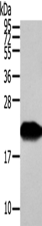 Anti-VPS25 Rabbit Polyclonal Antibody