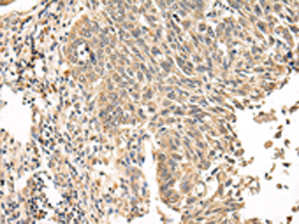 Anti-VPS53 Rabbit Polyclonal Antibody