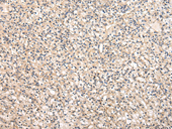 Anti-VPS37A Rabbit Polyclonal Antibody