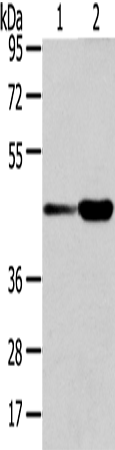 Anti-VPS37A Rabbit Polyclonal Antibody