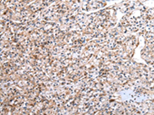 Anti-DCAF7 Rabbit Polyclonal Antibody