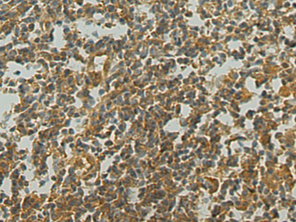 Anti-WDR77 Rabbit Polyclonal Antibody