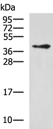 Anti-WDR77 Rabbit Polyclonal Antibody