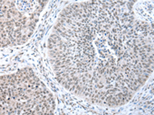 Anti-WRAP53 Rabbit Polyclonal Antibody