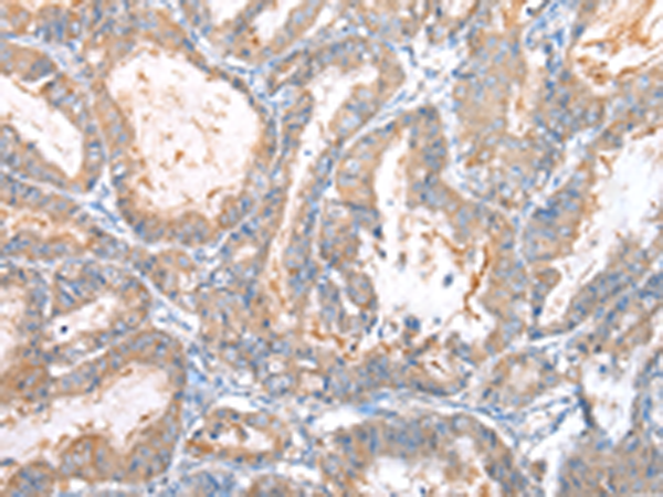 Anti-WIF1 Rabbit Polyclonal Antibody
