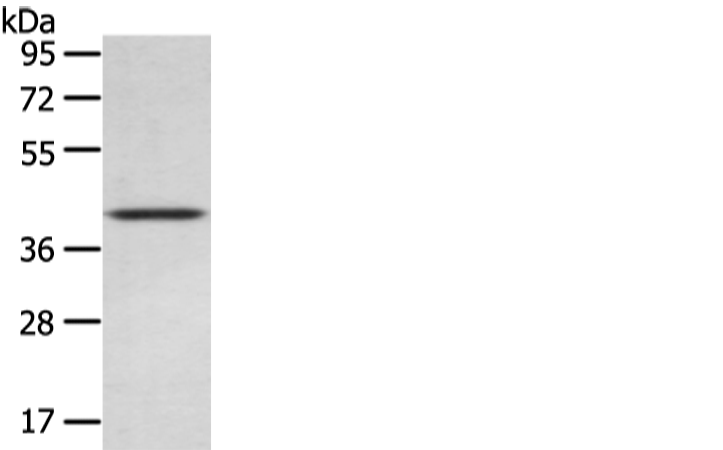 Anti-WIF1 Rabbit Polyclonal Antibody