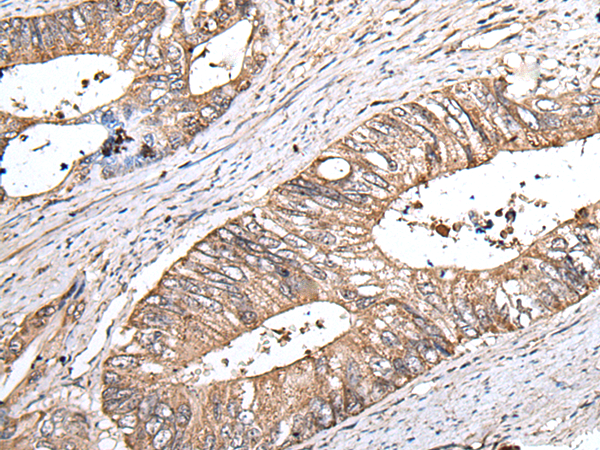 Anti-ZNHIT1 Rabbit Polyclonal Antibody