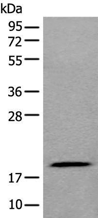 Anti-ZNHIT1 Rabbit Polyclonal Antibody