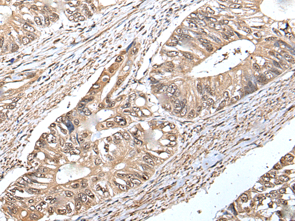 Anti-ATF6B Rabbit Polyclonal Antibody