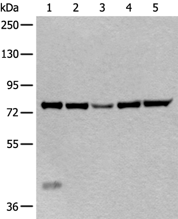 Anti-ATF6B Rabbit Polyclonal Antibody