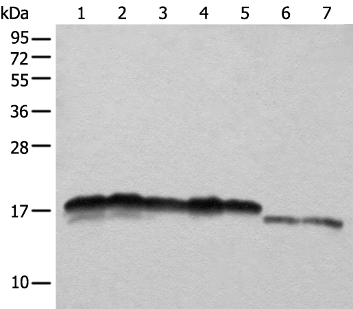 Anti-NDUFB11 Rabbit Polyclonal Antibody