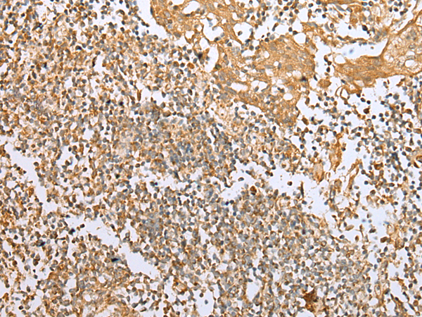 Anti-NDUFB3 Rabbit Polyclonal Antibody