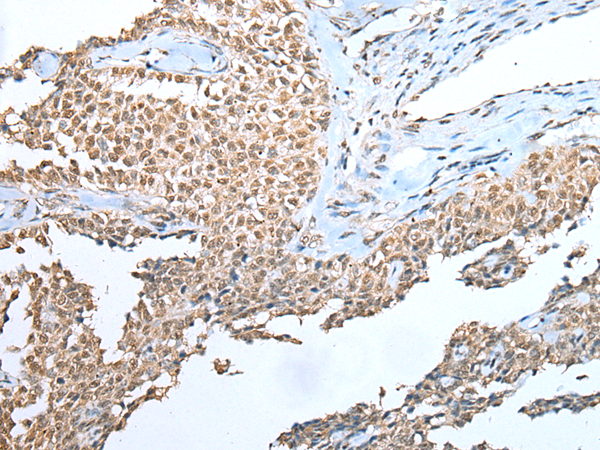 Anti-TIGD5 Rabbit Polyclonal Antibody