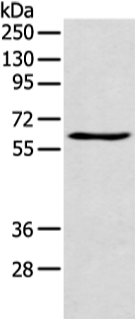 Anti-TIGD5 Rabbit Polyclonal Antibody