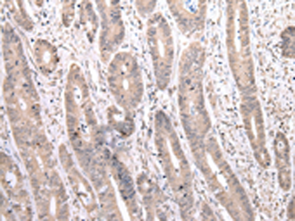 Anti-PCID2 Rabbit Polyclonal Antibody